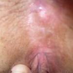 Just a close up of my swollen clit after masterbating
