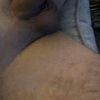 Bald dick