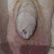 Small dick and hairy balls
