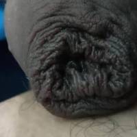 Natural skin of my dick