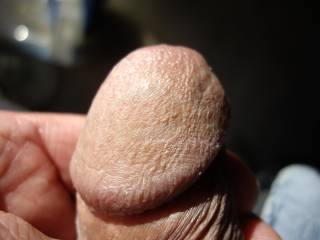 dirty dick head