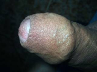 Uncut cock