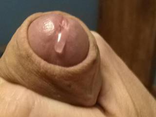 Does this foreskin make me look fat?