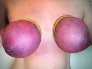 my tits tied tight with many layers of rubber bands until they turned purple