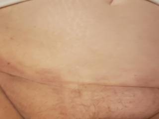 Belly shot