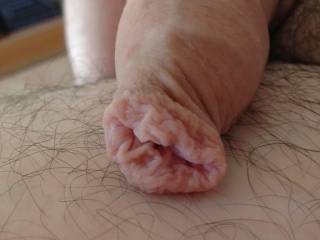 Foreskin 4