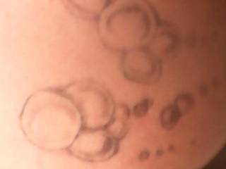 Tattoos of bubbles on my ass