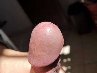 My circumcised mushroom penis head