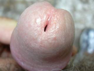 a circumcised cock head to die for- would love to suck your ridged glans dry...