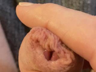 Does my foreskin look interesting here?