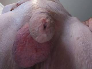 Foreskin and balls