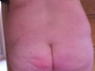 My arse, bit pink after hot shower