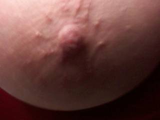 Another closeup of Barb's nipple