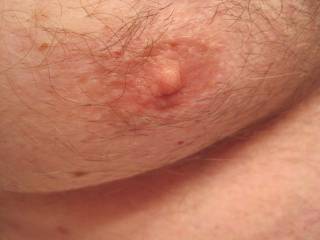 Close up of my little nipple. I sure wish I had some eraser size nips.