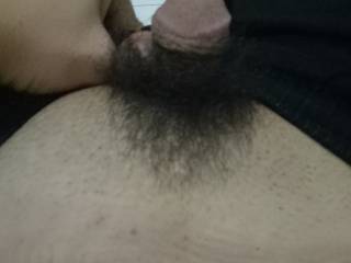 That photo is mine. I have just finished circumcised
