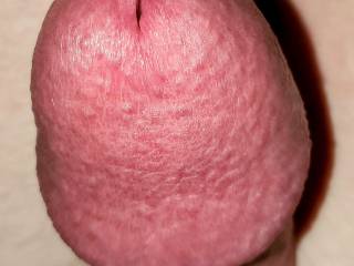 Big white swollen cock dick head close-up