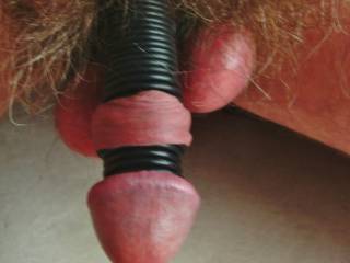 Cock with rubber rings on shaft, foreskin rolled back and more rubber rings behind glans