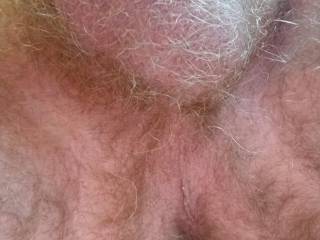 My Hairy butt.
