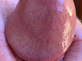 Swollen head of my cock